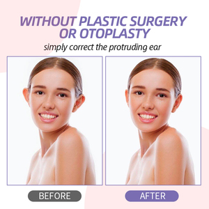 YuMeBeauty Nuevo <span class=keywords><strong>Corrector</strong></span> <span class=keywords><strong>de</strong></span> Orejas Adhesivo <span class=keywords><strong>de</strong></span> Silicona para Adultos, Moderno, Indoloro y Duradero - Product Image 5