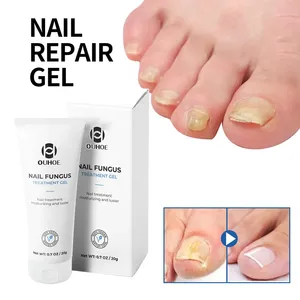 Hot Anti fungino Cream Nail Hand Foot Nail Fungus Removal Gel Anti infezione onicomicosi Nails Repair unguento 20g - Product Image 6