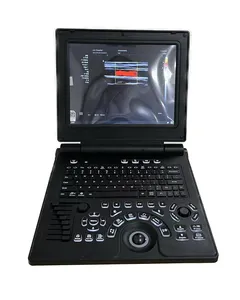 Chine Moins cher Portable 3D/4D Couleur Doppler Échographie Écho Machine, Diagnostic Système À Ultrasons pour Clinique MSLCU02