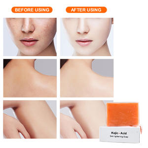 <span class=keywords><strong>Savon</strong></span> Bio Éclaircissant Marque Blanche en Gros <span class=keywords><strong>Kojie</strong></span> <span class=keywords><strong>San</strong></span> – Acide Kojique <span class=keywords><strong>Original</strong></span> qui Réduit les Taches Brunes - Product Image 4