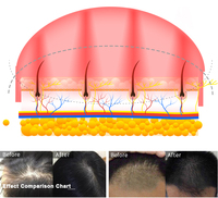 Gorro de Terapia Láser Frío de Baja Intensidad, 552 Diodos, Luz Roja de 655nm, Casco para Crecimiento del Cabello, Recargable, Grado Médico CE, OEM