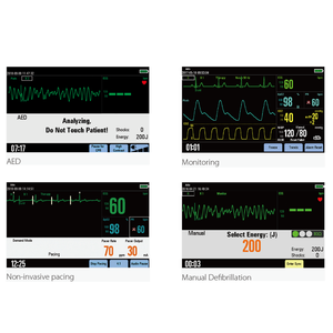 Défibrillateur portable Mindray BeneHeart D3, moniteur 4 en 1, défibrillation intégrée, DEA, dispositif de surveillance du rythme cardiaque, vétérinaire - Product Image 6