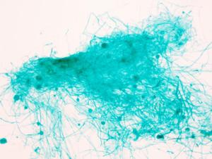 Portaobjetos de Microscopio con Algas y <span class=keywords><strong>Hongos</strong></span> para la Enseñanza de Biología en Secundaria, Especímenes Preparados con Estructuras Fúngicas Típicas, ISO - Product Image 3