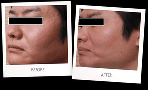 Alat Bedah Kecantikan Medis Meja Portabel, <span class=keywords><strong>Laser</strong></span> <span class=keywords><strong>CO2</strong></span> dengan Pisau Bedah <span class=keywords><strong>Laser</strong></span> - Product Image 6