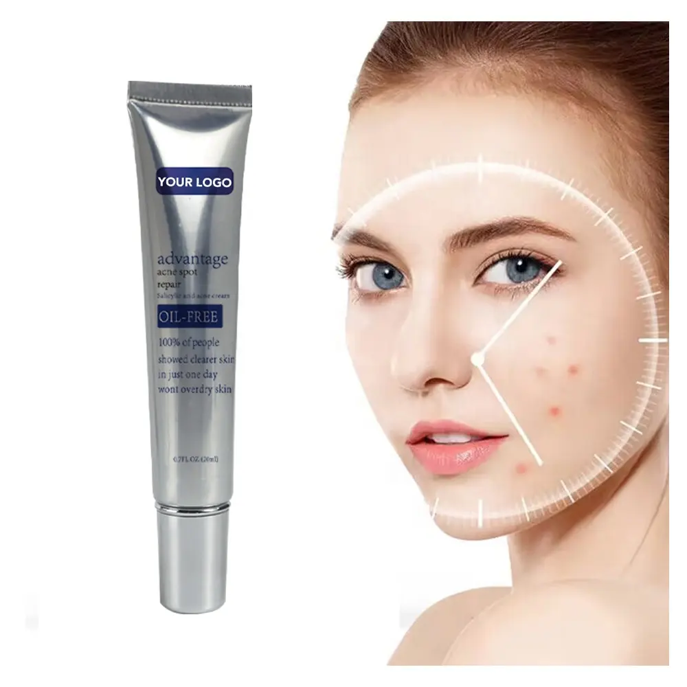 Creme anti-acne em gel para tratamento de acne com ácido salicílico, creme removedor de espinhas de alto produto