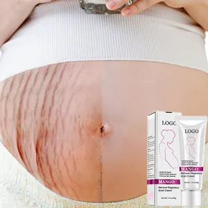 Nhãn Hiệu Riêng Tốt Nhất Stretch Marks Người Bán Kem Sau Khi Sinh Sửa Chữa Hữu Cơ Tự Nhiên Aloe Vera Stretch Marks Loại Bỏ Kem