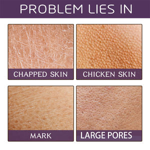 EELHOE 60g Gommage corporel à la niacinamide et à la mûre, hydratant, éclaircissant, adoucissant, lissant, exfoliant, nettoyant les impuretés - Product Image 3