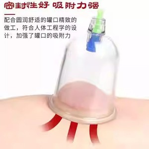 Juego de ventosas de vacío para investigación médica nacional, 24 unidades, material ABS, para uso doméstico, terapia de medicina tradicional china - Product Image 2