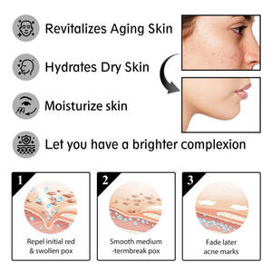 Crème à l'escargot OUHOE, soin hydratant et raffermissant doux pour la peau du visage, essence nourrissante - Product Image 2