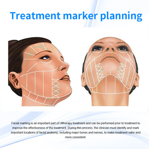 Appareil de lifting du visage et du corps à ultrasons haute fréquence anti-âge Hefu 2.0 de nouvelle génération, machine de suppression des rides SMAS - Product Image 4