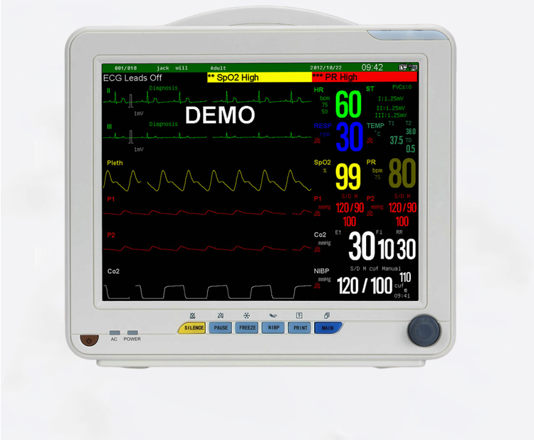HD Veterinary Ultrasound Machine Animal B