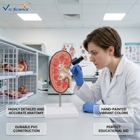 Modelo Anatómico Patológico de Cálculos Renales, Modelo de Comparación de Lesiones por Nefrolitiasis para la Enseñanza de Urología CE/ISO/ROHS/CNAS
