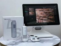 DS-3 AI Trichoscope 16MP Camera 4 Probes 10X-200X Hair Mirror Scalp Analyzer Follicle Detector Android