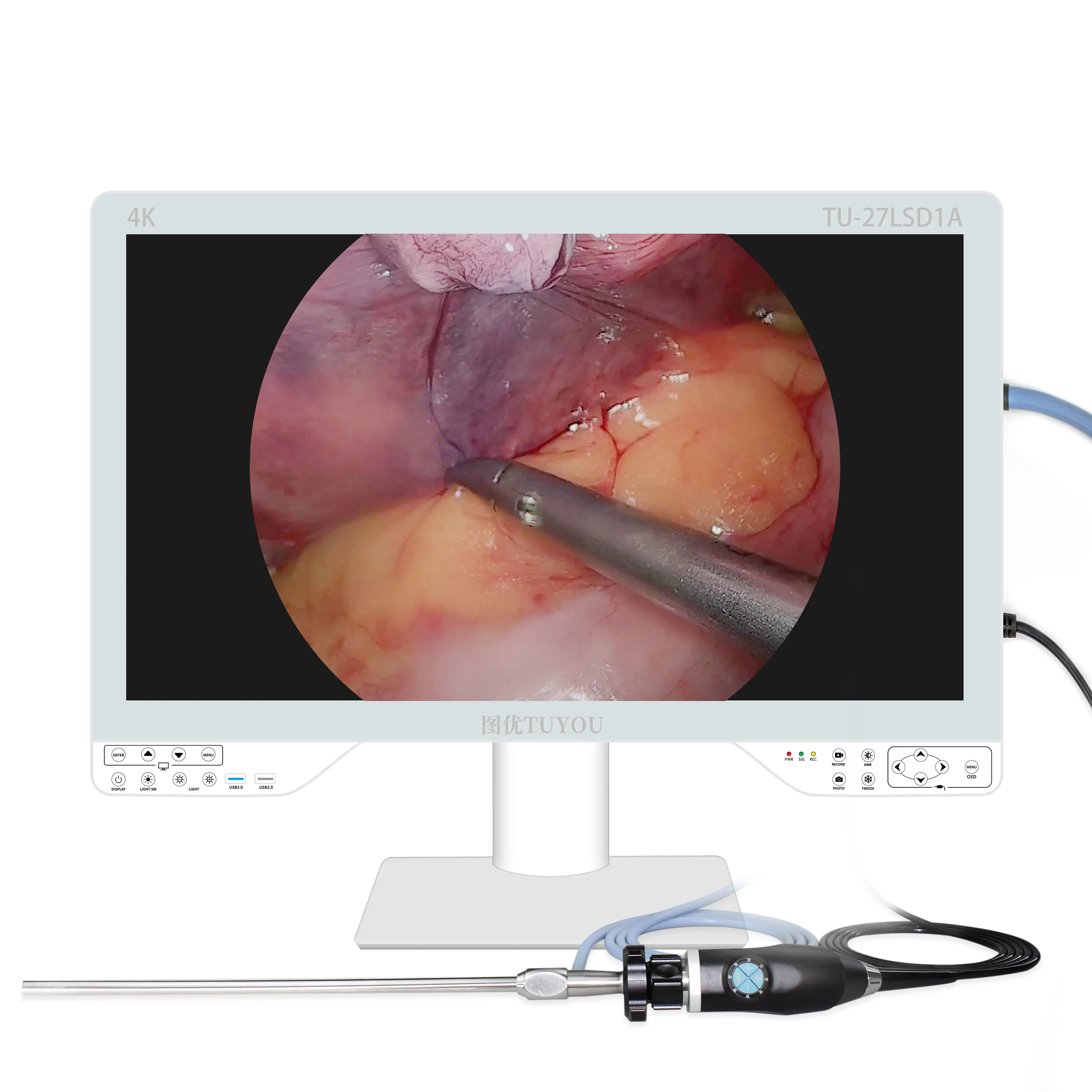 Equipo de endoscopia de cámara 4K UHD todo en uno para uteroscopio laparoscopio ENT