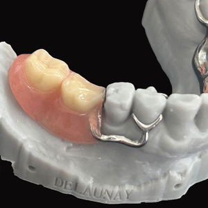 Marco de metal completo de mandíbulas <span class=keywords><strong>superior</strong></span> e inferior con <span class=keywords><strong>dentadura</strong></span> acrílica <span class=keywords><strong>parcial</strong></span> Precios súper bajos - Product Image 5