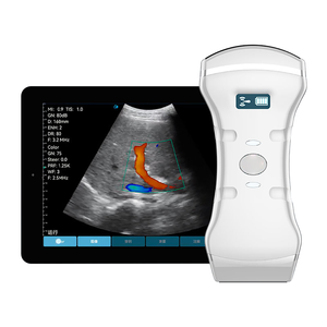 256 elementos en fase, lineal y convexo, sonda de matriz transvaginal 3 en 1 escáner <span class=keywords><strong>Doppler</strong></span> a color máquina de ultrasonido portátil - Product Image 1