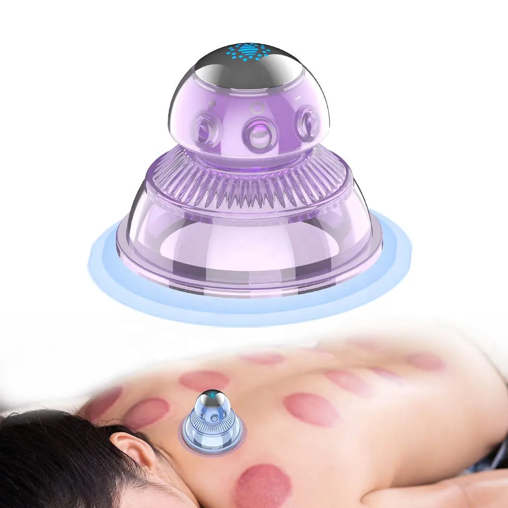 Elektrische Cupping Vacuümmassage Huishoudelijke Sterkere Zuignappen Ems Pulse Siliconen Cupping Therapie Voor Myofascial Massage Spier