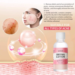 Serum Trị Mụn Axit Salicylic Hữu Cơ Tự Nhiên Nhãn Hiệu Riêng Cho Mọi Loại Da Kem Dưỡng Khô Trị Mụn Chống Mụn - Product Image 5