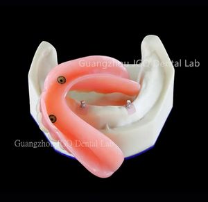 उच्च गुणवत्ता वाले व्यक्तिगत अनुकूलन पूर्ण-मुंह वाले डेबेंचर मुंह में बड़ी संख्या में लापता दांतों की मरम्मत - Product Image 3