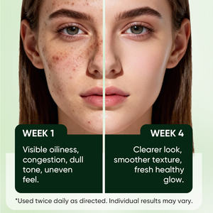 Nettoyant Moussant Doux MOOYAM Houttuynia cordata à Marque Blanche pour Nettoyage en Profondeur, Éclaircissement des Taches Légères et Contrôle du Sébum - Product Image 6