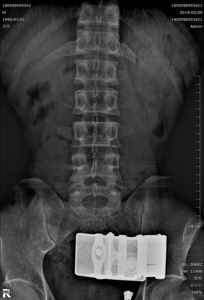 デジタルフラットパネル検出器医療用X線DR装置付属品X線X線技術カセットサイズ1417 - Product Image 6