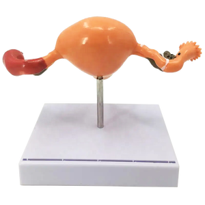 Modelo de útero patológico para mujer, modelo médico femenino para demostración - Product Image 5