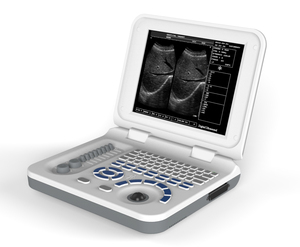 Appareils d'échographie médicale vétérinaire portables entièrement numériques pour moutons, chiens, chats, porcs, machine à échographie noir et blanc - Product Image 4