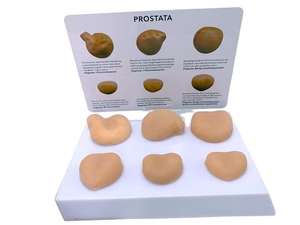 PVC massa della prostata modello anatomico strumento di apprendimento tattile per l'educazione medica - Product Image 6