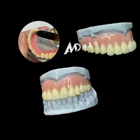 Prothèse complète de qualité supérieure - Restauration complète des dents d'apparence naturelle, prothèse complète en acrylique |   pour les laboratoires ou les cliniques | Fabriqué dans le Guangdong