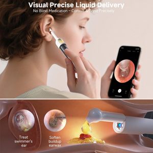 Limpiador de Oídos Visual Inteligente HD Portátil, Recargable, con Luz LED, Conexión Wifi, Herramienta Eléctrica para Remover Cera de Oídos con Cámara - Product Image 2