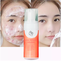 Sérum Visage 4-en-1 Marque Blanche Acide Azélaïque Vitamine C Niacinamide Anti-Acné Élimination des Pores Blanchissant Peeling Corporel Liquide