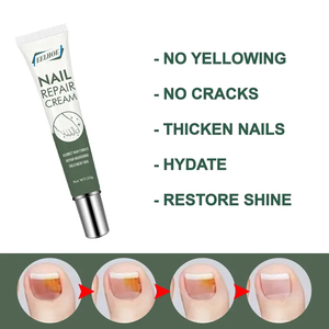 Gel para eliminar hongos, productos para el cuidado de manos y pies, crema para hongos en las uñas y pies, antiinfección, onicomicosis, paroniquia, reparación de uñas - Product Image 2