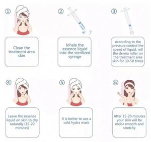 0.25/0.5/1mm kim loại Derma con lăn cho chống cellulite & Winkle loại bỏ massage mặt con lăn giảm béo Khung Sợi Tính năng vĩnh viễn - Product Image 5