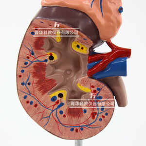 Modèle de rein humain ; anatomie du rein ; modèle agrandi de la glande surrénalette ; rein malade ; anatomie des organes internes humains. - Product Image 1