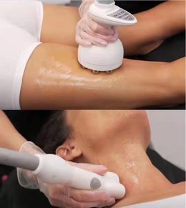 Dispositivo de Tratamiento de Celulitis y Reducción de Arrugas No Invasivo, Rodillo de Masaje en Forma de V 4D, Máquina de Reducción de Celulitis - Product Image 4