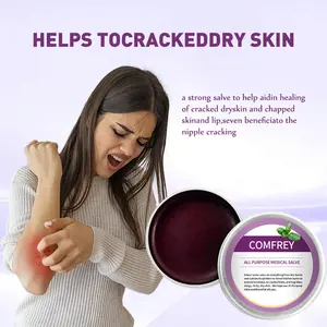 Comfrey Ointment Nourishes Protects and Heals Skin Soothes Dry Skin Bruises Rashes Abrasions burn care ointment cream