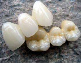 معدات التدفئة المختبرية 1700C لأعمال الخزف والأسنان - Product Image 6