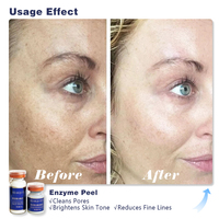 Masque exfoliant enzymatique coréen, kit d'essence de protéase, masque enzymatique de protéase, masque exfoliant, resurfaçage, resserrement des pores, peeling enzymatique B