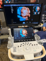 Ecógrafo Doppler Color 3D 4D SonoScape P80 ELITE de Alta Calidad con Software Profesional de IA para Hospitales y Clínicas