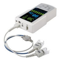 Oxymètre de pouls portable de 5 pouces avec capteur etco2 et batterie rechargeable spo2