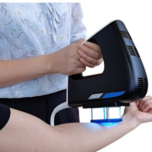 Láser Excimer de Alta Potencia con <span class=keywords><strong>Luz</strong></span> UVB para Vitiligo y Psoriasis, Equipo de Fisioterapia, 308nm, Aprobado por CE Médico - Product Image 6