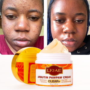 Crème éclaircissante pour le visage naturelle, à l'arbutine et à la niacinamide, réduit les taches brunes et l'acné, hydrate et nettoie, crème pour le visage 80 ml - Product Image 1