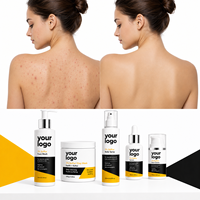 Set de Cuidado para el Acné de Última Tendencia: Piel Limpia, Purifica los Poros, Calma la Irritación, Específico para Piel Sensible, Set de Cuidado con Azufre Natural