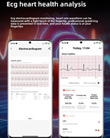 Nuevo Reloj Inteligente con Llamadas Bluetooth, Examen Físico, ECG, PPG, Monitoreo de Oxígeno en Sangre, Sueño y Salud, Compatible con Sistemas iOS y Android