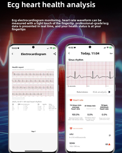 Nuevo Reloj Inteligente con Llamadas Bluetooth, Examen Físico, ECG, PPG, Monitoreo de Oxígeno en Sangre, Sueño y Salud, Compatible con Sistemas iOS y Android - Product Image 2