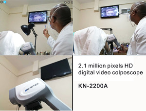 KN-2200A kỹ thuật số video soi cổ tử cung y tế thiết bị hình ảnh cho phụ khoa cổ tử cung và âm đạo kiểm tra soi cổ tử cung - Product Image 4
