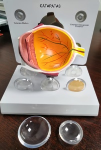 Modelo Anatómico Educativo del Ojo Humano en 3D, 3 Partes, de Plástico, para la Enseñanza de Ciencias Médicas y Cataratas - Product Image 3