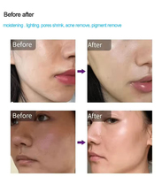 Appareil de mésothérapie à 9 aiguilles, injecteur sans aiguille, Dermashine Pro, injecteur Meso, machines de soin du visage Dermashine