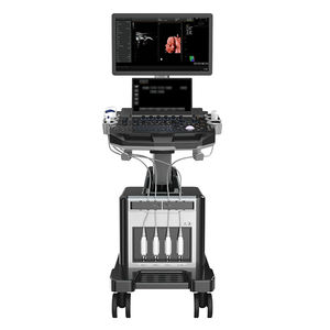 Escáner de Ultrasonido 4D Equipo Médico de Ultrasonido Instrumento de Diagnóstico por Ultrasonido en Color de Alta Definición - Product Image 1