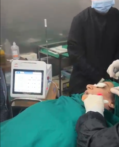 Nuevo Modelo de Endoláser 2026, Láser de Diodo de 980nm y 1470nm, Máquina de Lifting Facial Endolift, Precio de Máquina Láser para Liposucción - Product Image 3